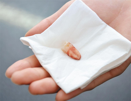 
	�������� ���� ����� ġ�Ƹ� �ǽ������� ����
�ϴ� ���� �ҹ��̴�. ������ ��κ��� ġ���
���� �ǽ��� ���� �Ƿ� ��⹰ ������ ������
�� �ִ�. / �����Ϻ�DB
