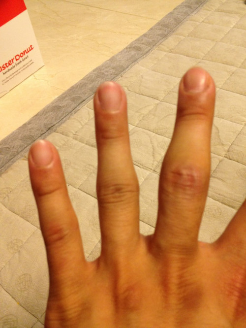 
	'��Ÿ' �ڼ���, ���� �̹��� Ż�ٲ� ����
