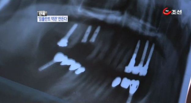 
	[8�ô��� '��' �ܵ�] ���ö�Ʈ����� ǥ�ؾ�� �����  
