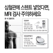 �������� ����Ʈ(�����θ��� ��ƿ ����) �־��ٸ�, MRI �˻� �����ϼ���