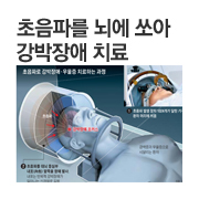 �����ĸ� ���� ��� �������(�ҾȰ��� ���ߵ� Ư�� �ൿ�� ����ϴ� ������ȯ) ġ�ᡦ �ѱ� ���, �� �� ����