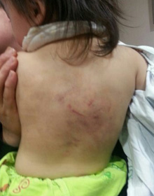 아동학대 원장-교사, 재개원-재취업 최대 10년 제한