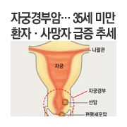 �ڱð�ξ�, 35�� �̸� ȯ�ڡ������ ���� �߼�