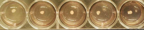 일본 요코하마시립대 의대 다니구치 히데키 교수팀이 유도만능줄기세포로 만든 간 씨앗.