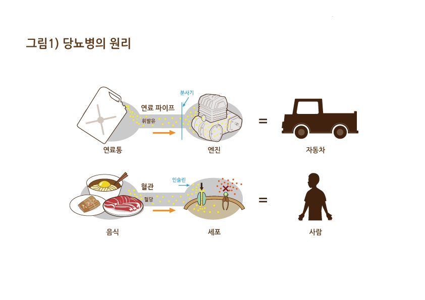 당뇨병은 영양실조다