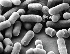 
	김치 유산균인 락토바실러스 플란타룸의 전자 현미경 사진.
