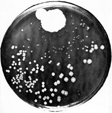 페니실린을 발견한 알렉산더 플레밍의 배양 접시예요. 푸른곰팡이 주변의 포도상구균이 죽은 모습이 보여요.