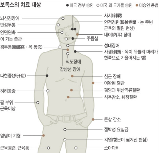 주름 제거에 효과적이라고 알려진 보톡스 시술도 주름의 종류와 깊이 정도에 따라 효과가 없을 수도 있다.