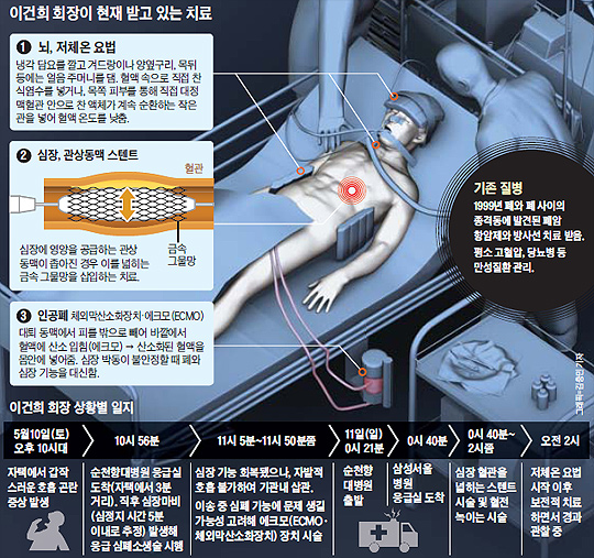 
		이건희 회장이 현재 받고 있는 치료 설명 그래픽
