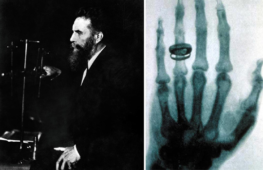 (왼쪽 사진)엑스선을 발견한 빌헬름 뢴트겐. 그의 연구 덕분에 의사들이 사람 몸속을 들여다보며 많은 생명을 살릴 수 있게 되었어요. (오른쪽 사진)빌헬름 뢴트겐이 촬영한 엑스레이 사진.