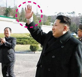 
북한 조선중앙TV가 8일 보도한 김정은 노동당 제1비서의&lsquo;평양 약전기계 공장&rsquo;현지 지도 장면. 김정은이 오른쪽 손목(점선)에 부상을 당한 듯 커다란 흰색 거즈와 반창고가 붙어 있다. /조선중앙TV
