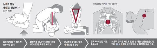 
		심폐소생술
