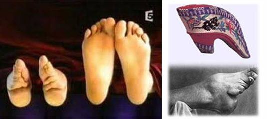 전족을 한 발과 정상적인 발(왼쪽), 전족을 한 발과 신발.