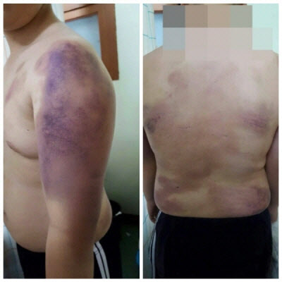 '기숙사 집단폭행' 경산 H대학 공식사과…재발방지 약속