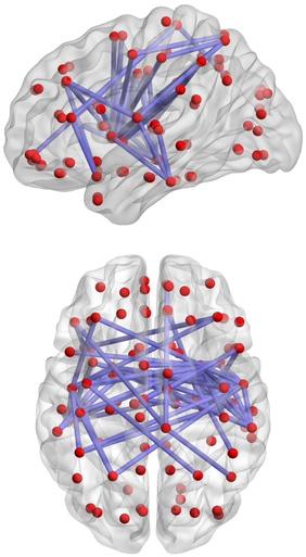  인간 뇌의 신경세포 연결을 형상화한 모식도/위키미디어 제공