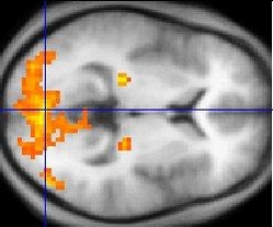  기능성 자기곰명영상촬영(fMRI)을 하면 인간 뇌의 특정 부분을 정밀하게 볼 수 있다./위키미디어 제공