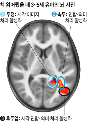 책 읽어?을 때 3~5세 유아의 뇌 사진