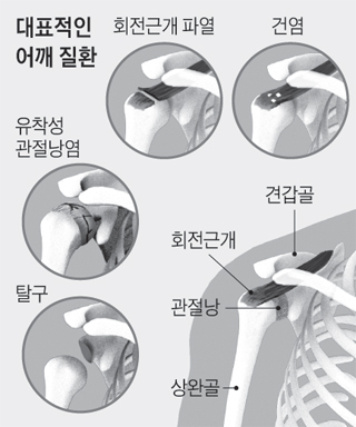 힘줄 이미지
