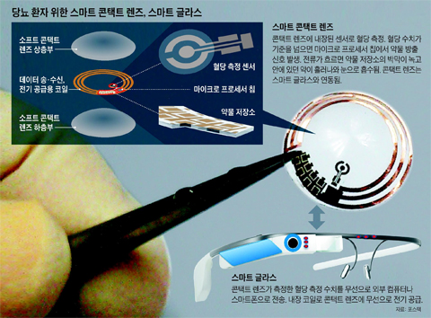 스마트 콘택트 렌즈 설명 그래픽