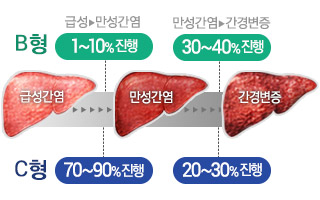 서울서 또 