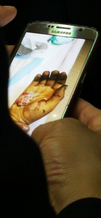 화상과 그을음투성이인 안치범씨의 손을 병원 직원이 핸드폰으로 찍은 사진을 유족들이 보고 있다.