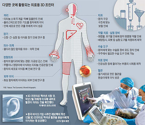 다양한 곳에 활용되는 의료용 3D 프린터