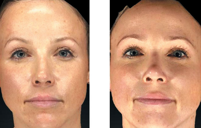 BEFORE / AFTER