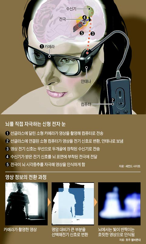 뇌를 직접 자극하는 신형 전자 눈
