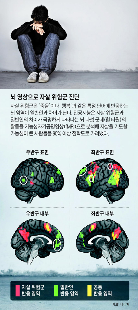 AI가 뇌 영상 분석… 자살 위험 미리 가려낸다