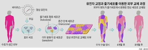 유전자 교정과 줄기세포를 이용한 피부 교체 과정