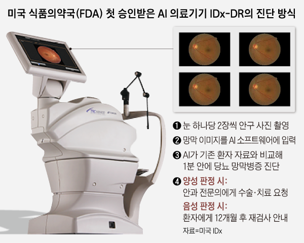 미국 식품의약국 첫 승인받은 AI 의료기기 IDx-DR의 진단 방식