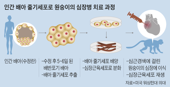 인간 배아 줄기세포로 원숭이의 심장병 치료 과정