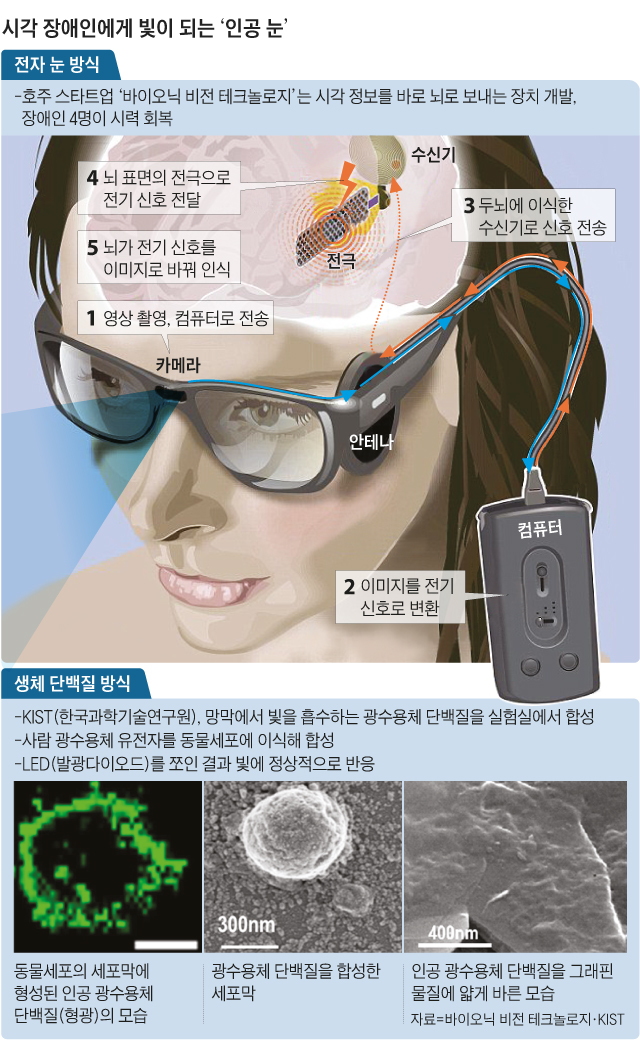 시각 장애인에게 빛이 되는 인공 눈 그래픽