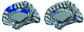 뇌 MRI 사진 속 파란 음영은 노화로 인지 기능을 담당하는 뇌피질이 얇아진 흔적을 표시한 것. 왼쪽 사진은 3개월 동안 인지기능 훈련을 받지 않은 사람들의 뇌 사진으로 파란 음영이 짙다. 오른쪽은 훈련을 받은 사람의 뇌로 음영이 거의 없다.