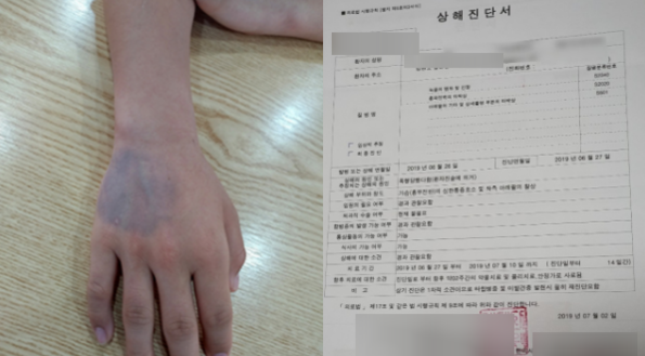 지난 6월 중학교 3학년생 7명에게 집단폭행을 당한 김모(14)군의 손과 전치 2주 상해진단서./박씨 제공