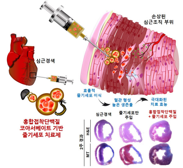 홍합이용한 줄기세포 치료/포스텍