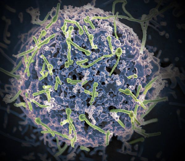 에볼라 바이러스(연두색)가 숙주세포에 달라붙어 있는 모습. 미국 연구진이 4종류의 에볼라 바이러스를 모두 예방하는 백신을 개발해 동물실험에서 효능을 확인했다./NIAID