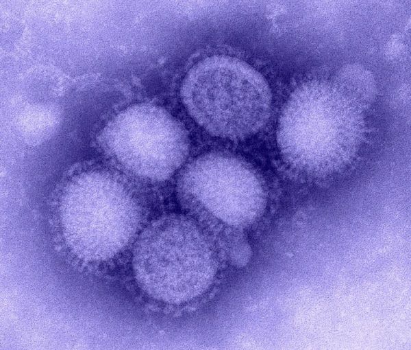 2009년 팬데믹을 부른 H1N1 신종 인플루엔자 바이러스의 전자현미경 사진. 중국의 돼지에서 발견된 인플루엔자 바이러스에 신종 플루 바이러스의 유전자가 발견됐다./CDC