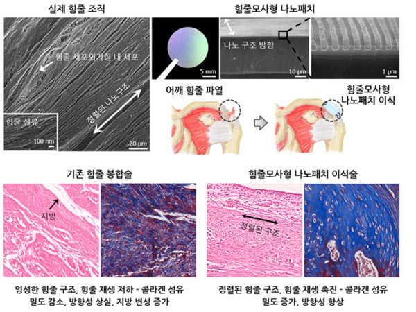 현재 사용되는 힘줄 봉합술에 비교해 전남대 연구팀이 개발한 지지체를 사용했을 때 월등히 향상된 힘줄 재생을 확인했다. /전남대 제공