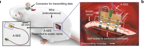 생쥐의 좌골 신경에 부착 된 탄성 물질로 만든 전자 의학 / 자연